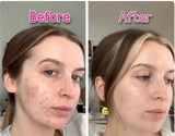 Rechargeable LED Facial Massager for Face & Neck - Vibrating Massager